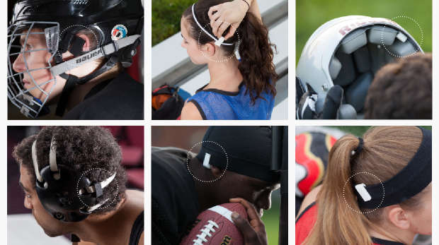Jolt Sensor Detects Concussion Risk in Real Time